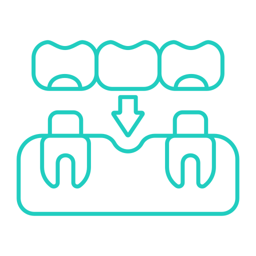 tooth-bridge